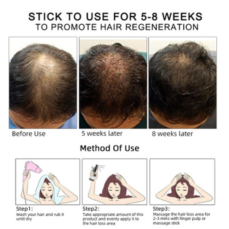 Hair Growth Essence Oil Hair Growth Oil Oem Hair Care Essential Oil