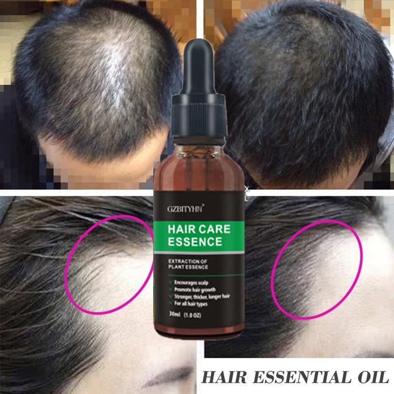 Hair Growth Essence Oil Hair Growth Oil Oem Hair Care Essential Oil