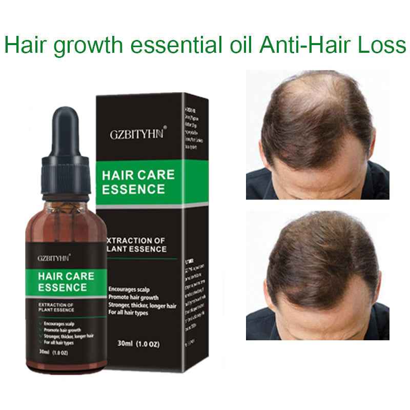Hair Growth Essence Oil Hair Growth Oil Oem Hair Care Essential Oil