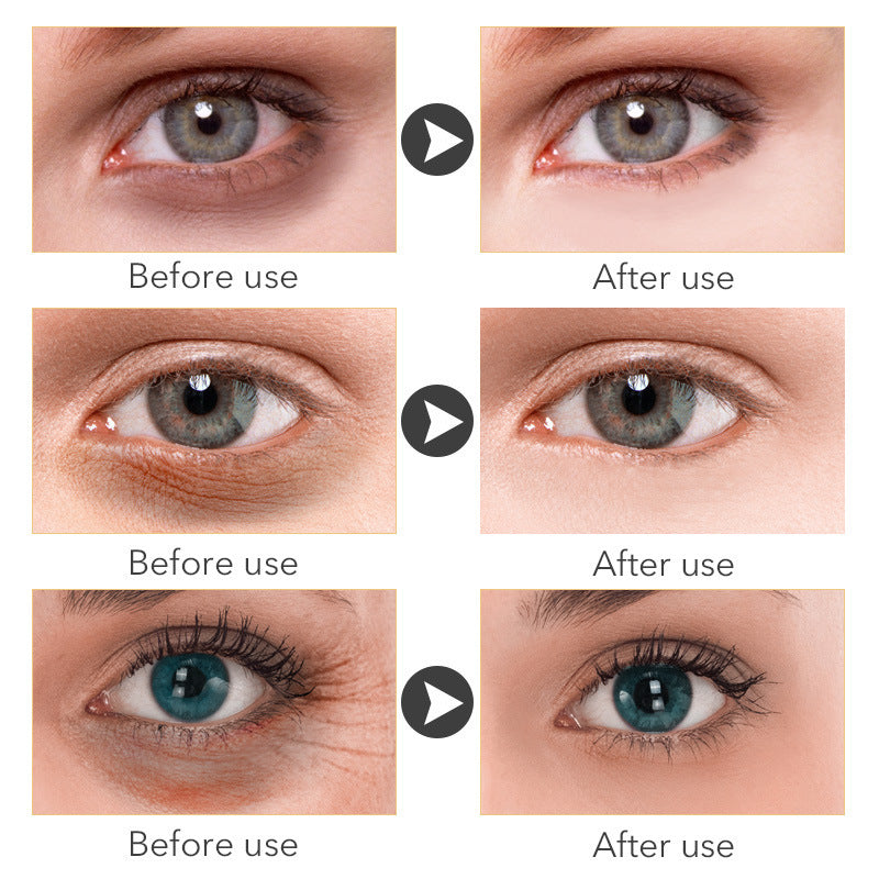 AnYi  Beauty Eye Cream 30ml wish Women's Skin Care