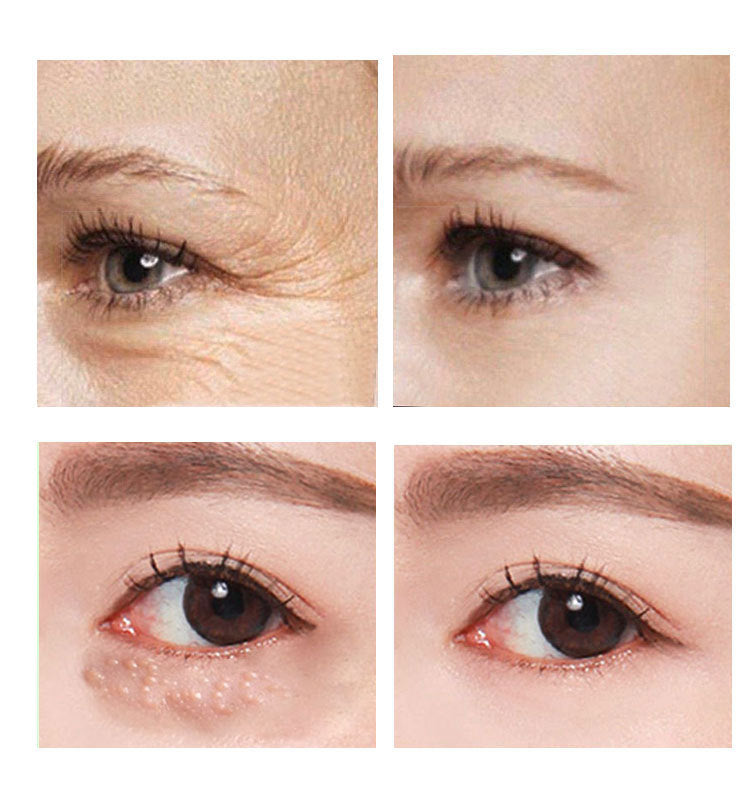 AnYi  Beauty Eye Cream 30ml wish Women's Skin Care
